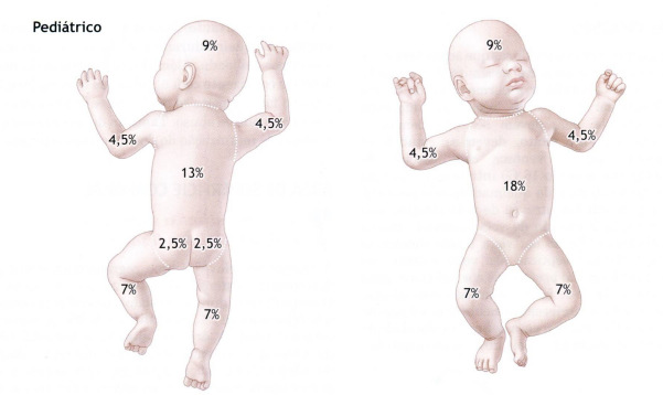 Cálculo de queimadura em criança