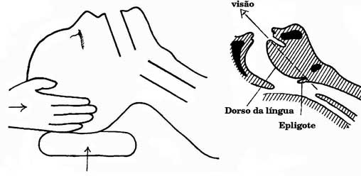 Posicionamento alternativo
